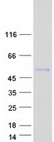 CMPK2 Protein - Purified recombinant protein CMPK2 was analyzed by SDS-PAGE gel and Coomassie Blue Staining
