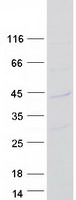 CMSS1 Protein - Purified recombinant protein CMSS1 was analyzed by SDS-PAGE gel and Coomassie Blue Staining