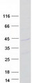 CMSS1 Protein - Purified recombinant protein CMSS1 was analyzed by SDS-PAGE gel and Coomassie Blue Staining