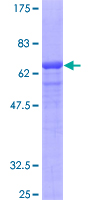 CMT2 / MAD2L1BP Protein - 12.5% SDS-PAGE of human MAD2L1BP stained with Coomassie Blue