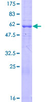 CMT2 / MAD2L1BP Protein - 12.5% SDS-PAGE of human MAD2L1BP stained with Coomassie Blue