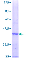 CMT2 / MAD2L1BP Protein - 12.5% SDS-PAGE Stained with Coomassie Blue.