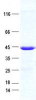 CMT2 / MAD2L1BP Protein