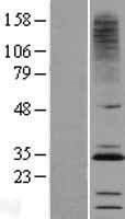 CMTM2 Protein - Western validation with an anti-DDK antibody * L: Control HEK293 lysate R: Over-expression lysate