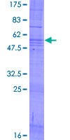 CMTM2 Protein - 12.5% SDS-PAGE of human CMTM2 stained with Coomassie Blue