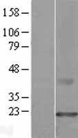 CMTM3 Protein - Western validation with an anti-DDK antibody * L: Control HEK293 lysate R: Over-expression lysate