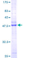 CMTM3 Protein - 12.5% SDS-PAGE of human CKLFSF3 stained with Coomassie Blue