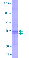 CMTM6 / CKLFSF6 Protein - 12.5% SDS-PAGE of human CMTM6 stained with Coomassie Blue