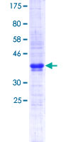 CMTM6 / CKLFSF6 Protein - 12.5% SDS-PAGE Stained with Coomassie Blue.