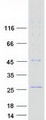 CMTM6 / CKLFSF6 Protein - Purified recombinant protein CMTM6 was analyzed by SDS-PAGE gel and Coomassie Blue Staining