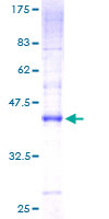 CMTM7 / CKLFSF7 Protein - 12.5% SDS-PAGE of human CKLFSF7 stained with Coomassie Blue