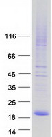 CMTM7 / CKLFSF7 Protein - Purified recombinant protein CMTM7 was analyzed by SDS-PAGE gel and Coomassie Blue Staining