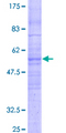 CMTM8 Protein - 12.5% SDS-PAGE of human CMTM8 stained with Coomassie Blue