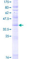 CMTM8 Protein - 12.5% SDS-PAGE of human CMTM8 stained with Coomassie Blue