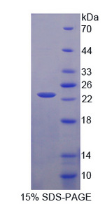 CMTM8 Protein - Recombinant  Chemokine Like Factor Superfamily 8 By SDS-PAGE