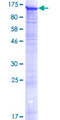 CMTR1 / FTSJD2 Protein - 12.5% SDS-PAGE of human KIAA0082 stained with Coomassie Blue