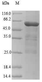 CMV gL Protein - (Tris-Glycine gel) Discontinuous SDS-PAGE (reduced) with 5% enrichment gel and 15% separation gel.