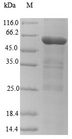 CMV gL Protein - (Tris-Glycine gel) Discontinuous SDS-PAGE (reduced) with 5% enrichment gel and 15% separation gel.
