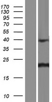CNBP / ZNF9 Protein - Western validation with an anti-DDK antibody * L: Control HEK293 lysate R: Over-expression lysate