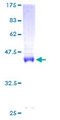 CNBP / ZNF9 Protein - 12.5% SDS-PAGE of human ZNF9 stained with Coomassie Blue