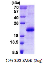 CNBP / ZNF9 Protein