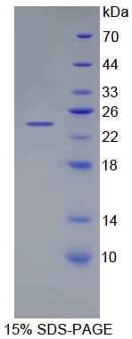 CNDP1 Protein - Recombinant  Carnosine Dipeptidase 1 By SDS-PAGE