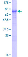 CNDP2 Protein - 12.5% SDS-PAGE of human CNDP2 stained with Coomassie Blue