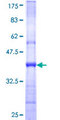 CNDP2 Protein - 12.5% SDS-PAGE Stained with Coomassie Blue.