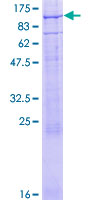 CNGA3 Protein - 12.5% SDS-PAGE of human CNGA3 stained with Coomassie Blue