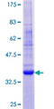 CNIH1 / CNIH Protein - 12.5% SDS-PAGE of human CNIH stained with Coomassie Blue