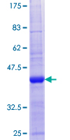 CNIH2 Protein - 12.5% SDS-PAGE of human CNIH2 stained with Coomassie Blue