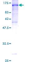 CNKSR1 Protein - 12.5% SDS-PAGE of human CNKSR1 stained with Coomassie Blue