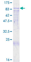 CNKSR3 Protein - 12.5% SDS-PAGE of human CNKSR3 stained with Coomassie Blue