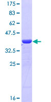 CNKSR3 Protein - 12.5% SDS-PAGE Stained with Coomassie Blue.