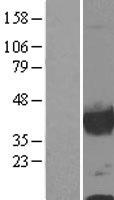 CNN1 / Calponin Protein - Western validation with an anti-DDK antibody * L: Control HEK293 lysate R: Over-expression lysate