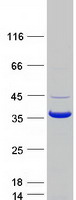 CNN1 / Calponin Protein - Purified recombinant protein CNN1 was analyzed by SDS-PAGE gel and Coomassie Blue Staining