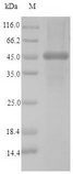 CNN2 Protein - (Tris-Glycine gel) Discontinuous SDS-PAGE (reduced) with 5% enrichment gel and 15% separation gel.