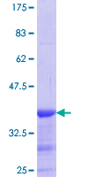 CNN2 Protein - 12.5% SDS-PAGE Stained with Coomassie Blue.