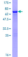 CNN3 Protein - 12.5% SDS-PAGE of human CNN3 stained with Coomassie Blue