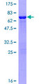 CNN3 Protein - 12.5% SDS-PAGE of human CNN3 stained with Coomassie Blue
