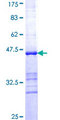 CNN3 Protein - 12.5% SDS-PAGE Stained with Coomassie Blue.