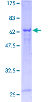 CNNM3 Protein - 12.5% SDS-PAGE of human CNNM3 stained with Coomassie Blue