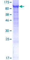 CNNM4 Protein - 12.5% SDS-PAGE of human CNNM4 stained with Coomassie Blue