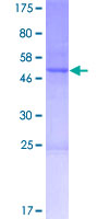CNO Protein - 12.5% SDS-PAGE of human CNO stained with Coomassie Blue