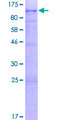 CNOT10 Protein - 12.5% SDS-PAGE of human CNOT10 stained with Coomassie Blue
