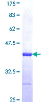 CNOT2 Protein - 12.5% SDS-PAGE Stained with Coomassie Blue.