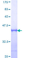 CNOT3 Protein - 12.5% SDS-PAGE Stained with Coomassie Blue.