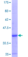 CNOT4 / CLONE243 Protein - 12.5% SDS-PAGE Stained with Coomassie Blue.