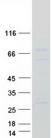 CNOT4 / CLONE243 Protein - Purified recombinant protein CNOT4 was analyzed by SDS-PAGE gel and Coomassie Blue Staining