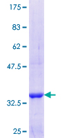 CNOT6 Protein - 12.5% SDS-PAGE Stained with Coomassie Blue.
